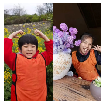 重庆自闭症康复